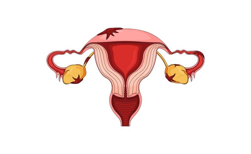 Março Amarelo: Larissa Manoela compartilha diagnóstico de endometriose e reforça importância da informação para mulheres